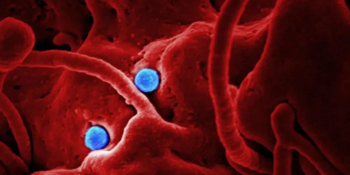 Argentina activa protocolos tras detectar embarcaciones desde zonas con brote de ébola