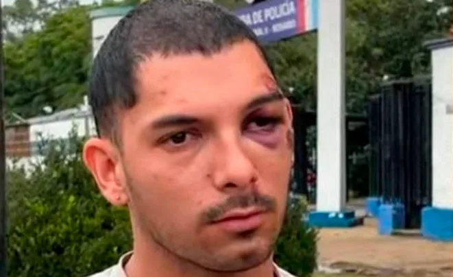 Joven busca testigos y pruebas tras ser arrastrado por un auto en pelea